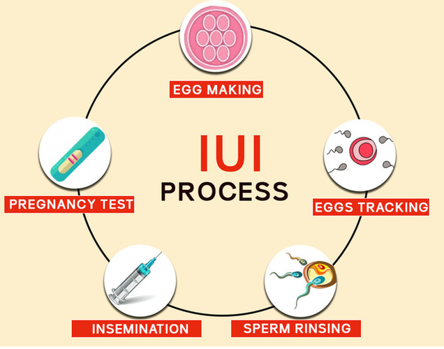 What is IUI?
